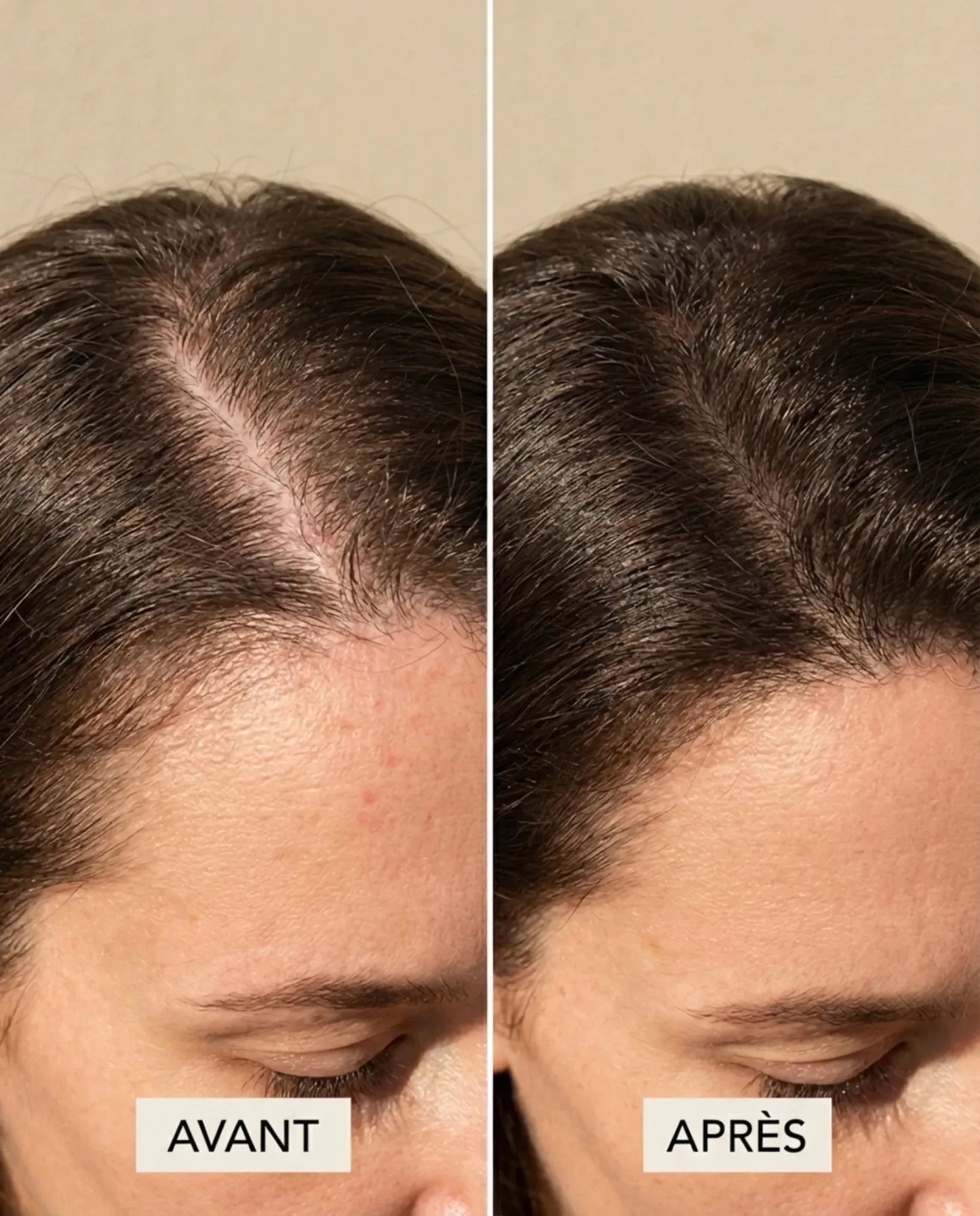 ScalpRevive — Peigne Massage Luminothérapie - Pressana