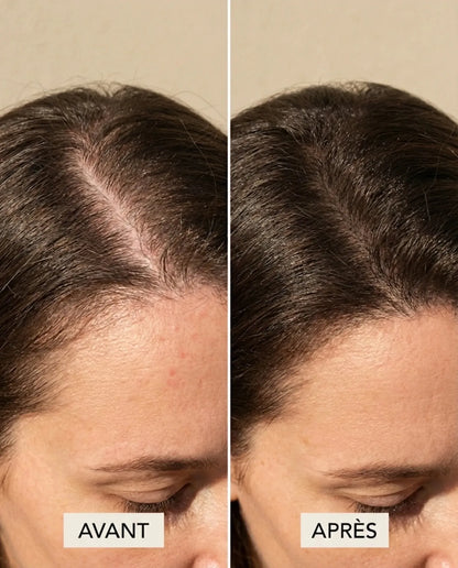 ScalpRevive — Peigne Massage Luminothérapie - Pressana